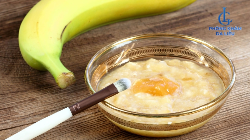 Làm mặt nạ chuối và sữa chua trị mụn tại nhà
