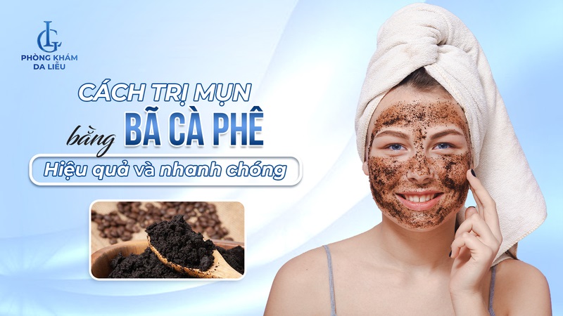 cách trị mụn bằng bã cà phê​