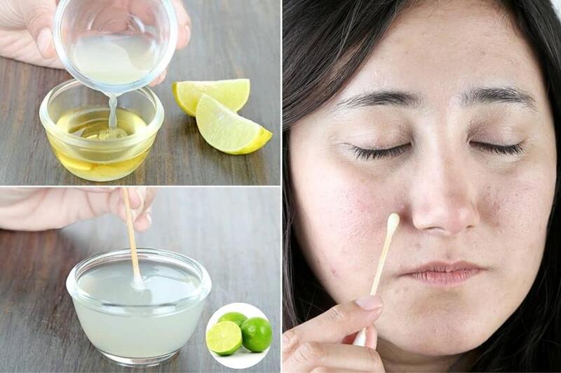 nước chanh pha loãng trị mụn