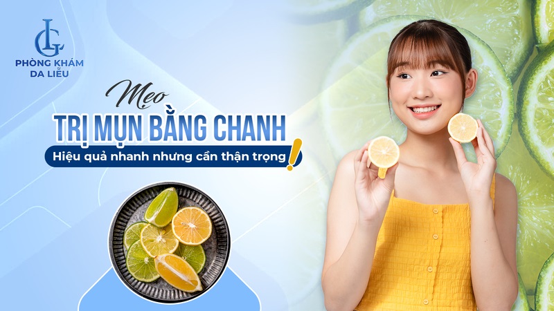 cách trị mụn bằng chanh