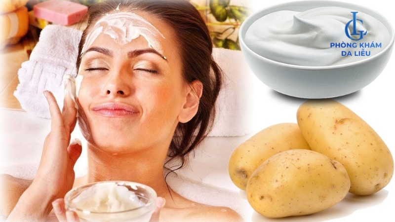 Cách trị mụn bằng khoai tây tại nhà