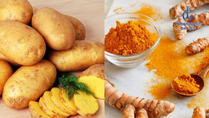 Khoai tây và nghệ