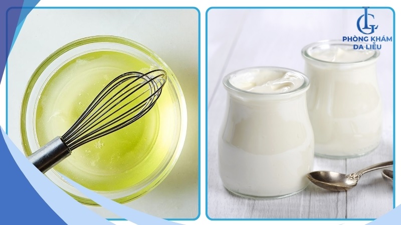 Trị mụn bằng lòng trắng trứng gà và sữa chua