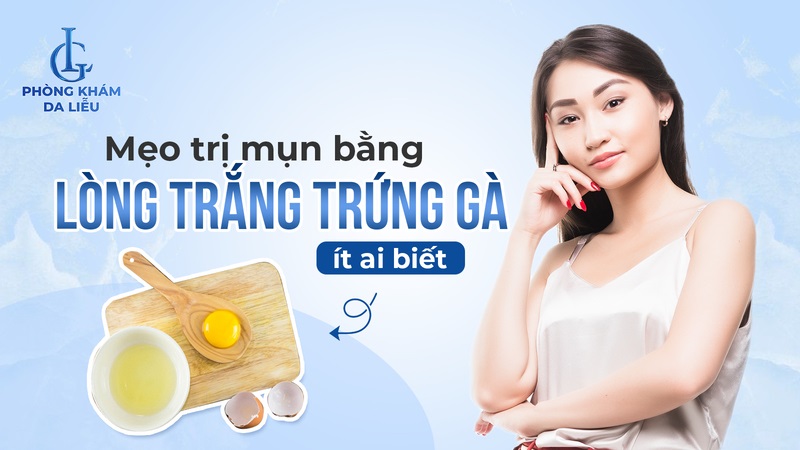 Trị mụn bằng lòng trắng trứng gà