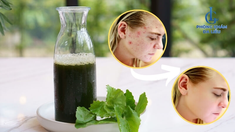 Uống nước rau má giúp trị mụn hiệu quả