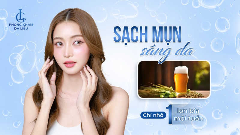 dùng bia trị mụn