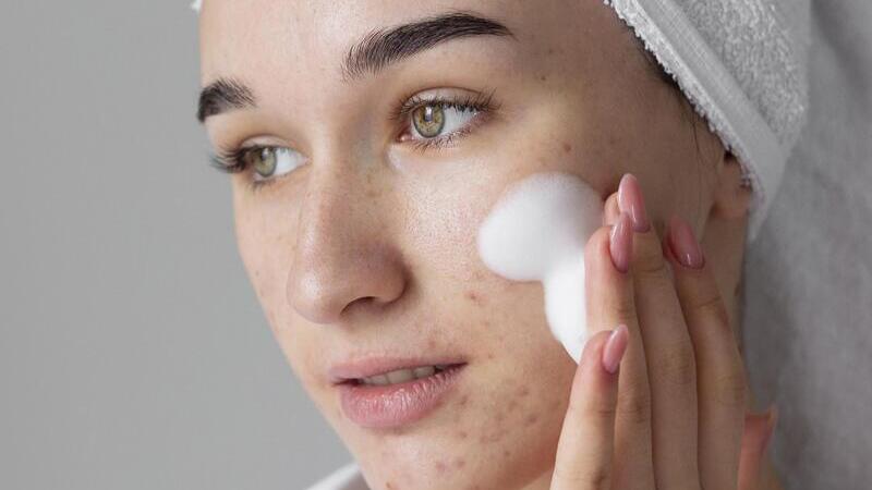 dùng sữa rửa mặt bị nổi mụn