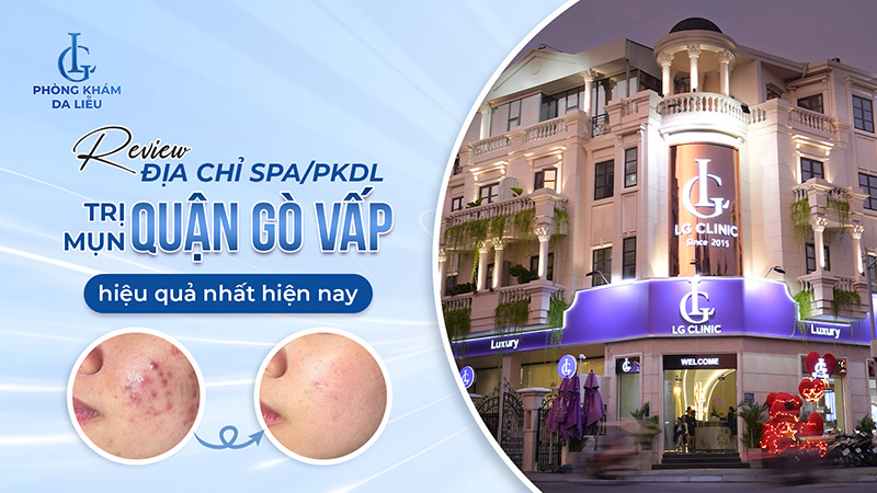 spa trị mụn gò vấp