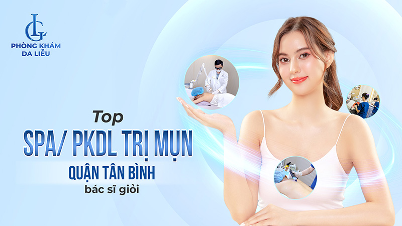 spa trị mụn tân bình