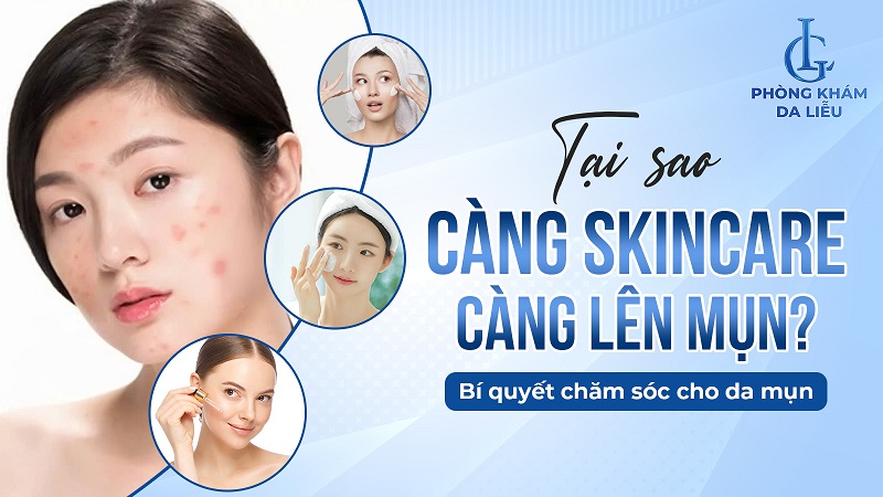 tại sao càng skincare càng lên mụn