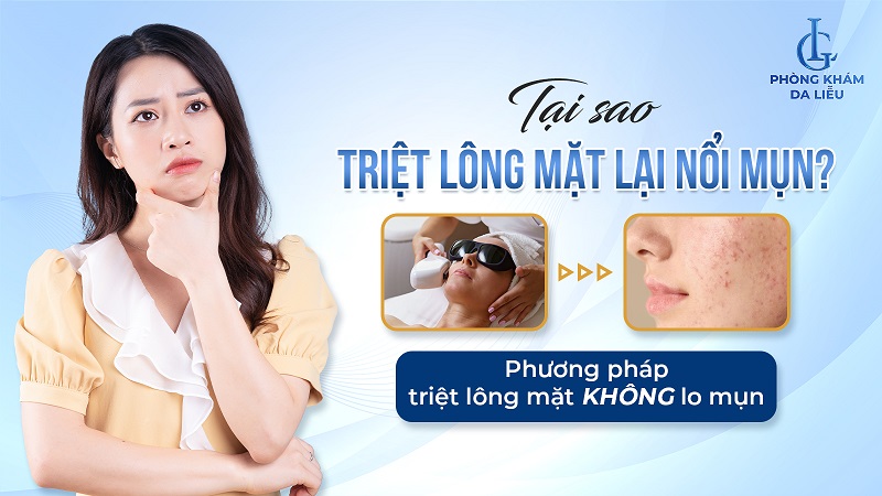Tại sao triệt lông mặt lại nổi mụn?