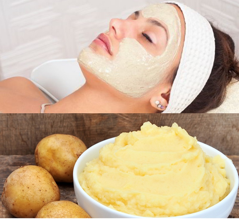 cách trị mụn bằng khoai tây​