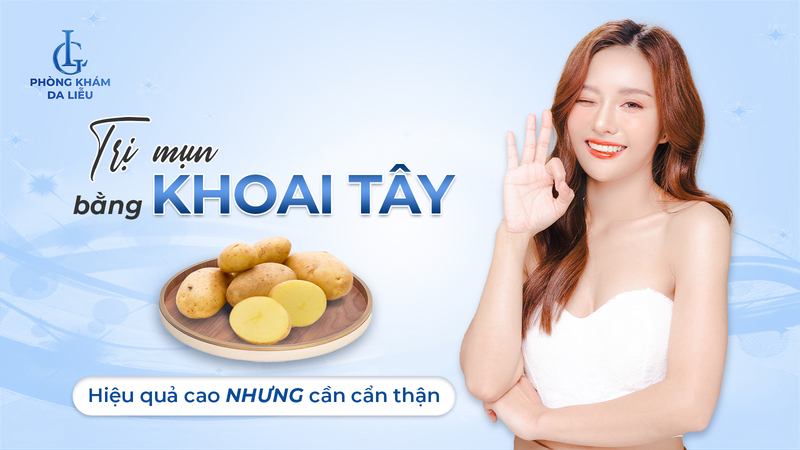 cách trị mụn bằng khoai tây​