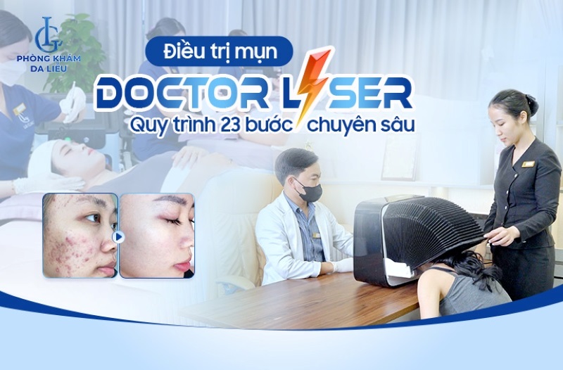 trị mụn doctor laser tại phòng khám da liễu lg