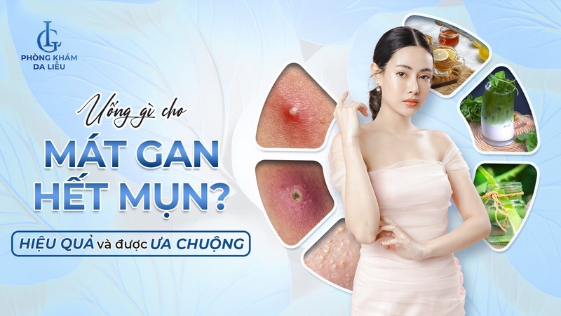 Uống gì cho mát gan hết mụn