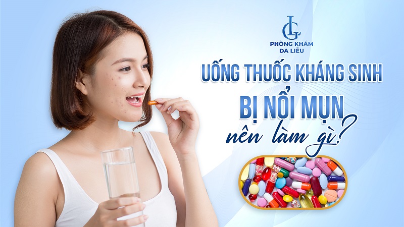 uống thuốc kháng sinh bị nổi mụn