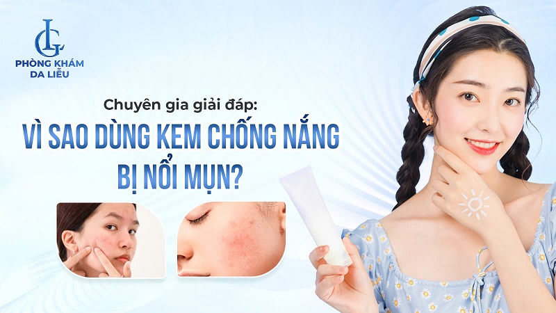 dùng kem chống nắng bị nổi mụn