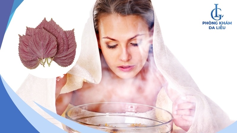 Xông mặt bằng lá tía tô trị mụn