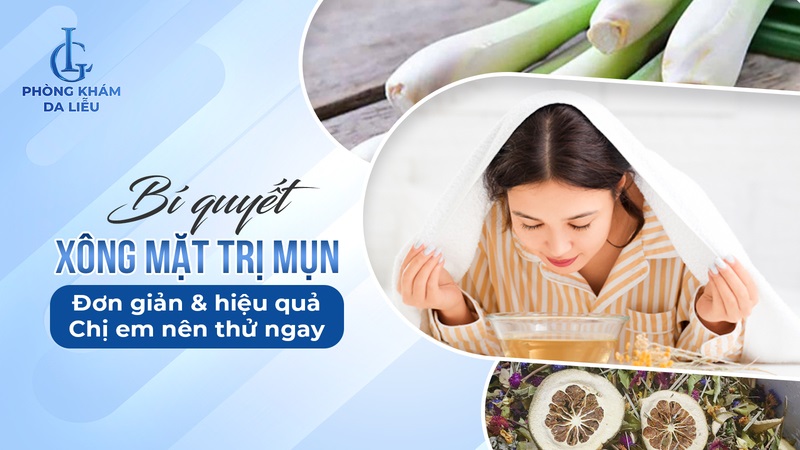 Xông mặt trị mụn