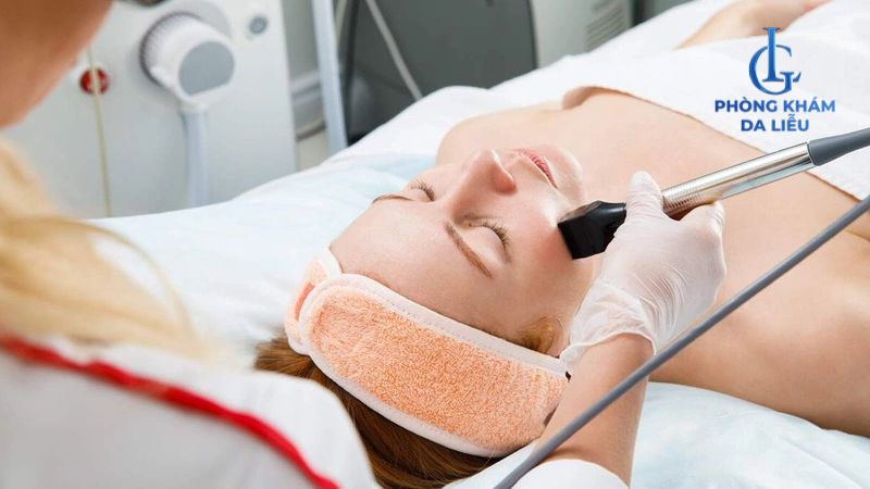 Điều trị sẹo rỗ nặng