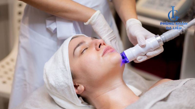 Điều trị sẹo rỗ nặng