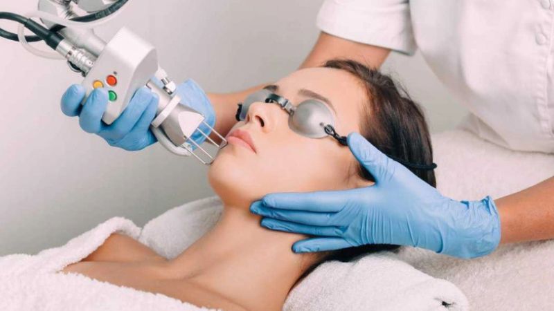 Mụn cám ở trán