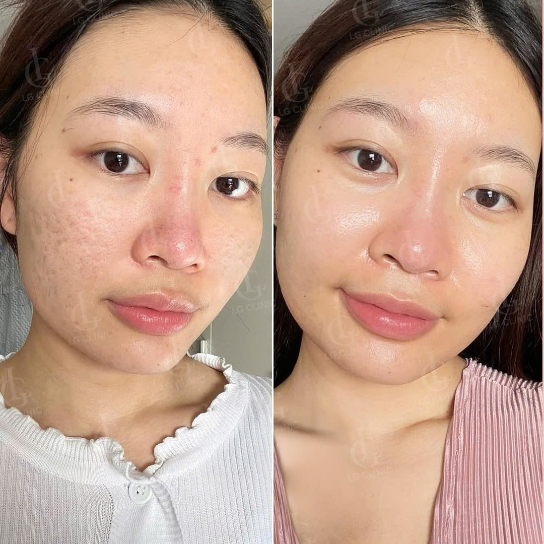 Kết quả điều trị
