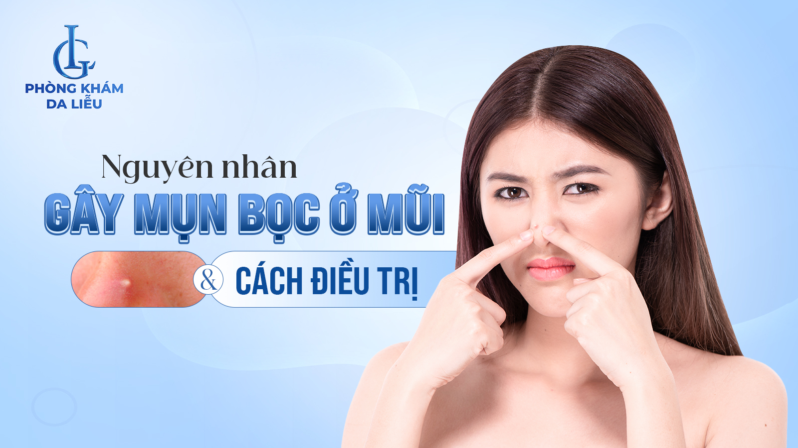 Mụn bọc ở mũi