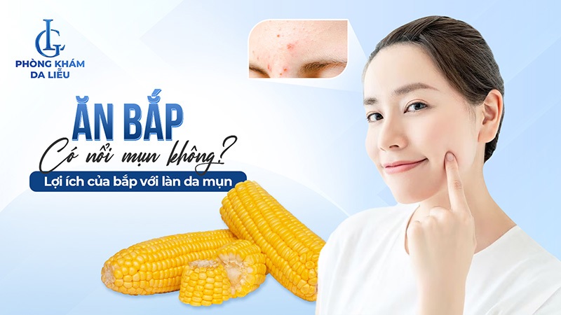 Ăn bắp có nổi mụn không