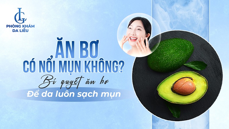 Ăn bơ có nổi mụn không