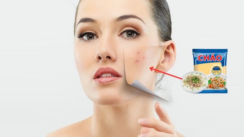 ăn cháo gói nổi mụn