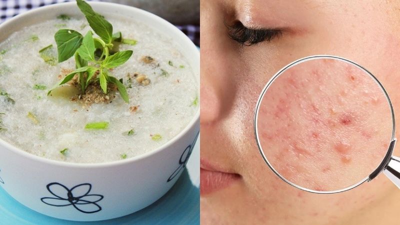 ăn cháo gói bị nổi mụn