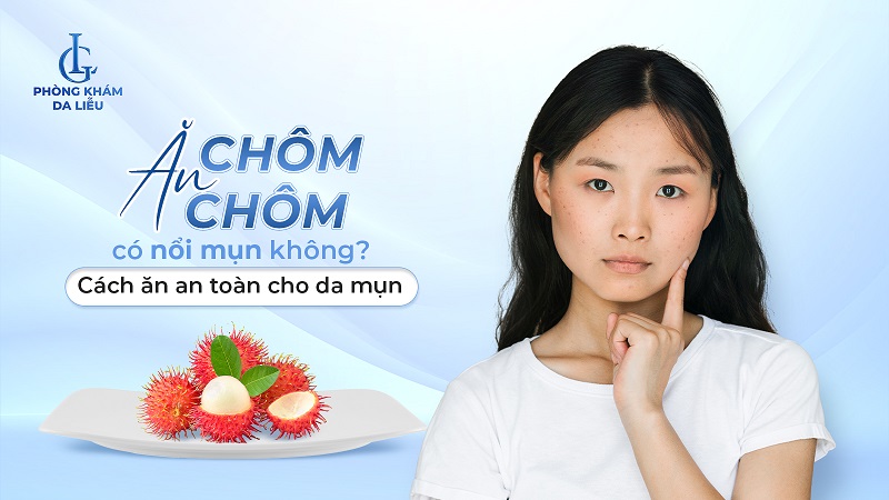 Ăn chôm chôm có nổi mụn không