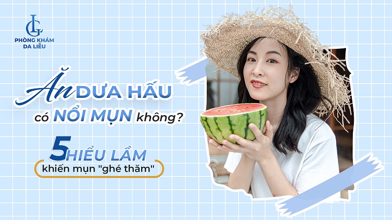 Ăn dưa hấu có nổi mụn không