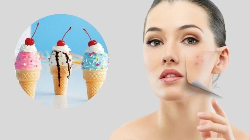ăn kem bị nổi mụn trên mặt