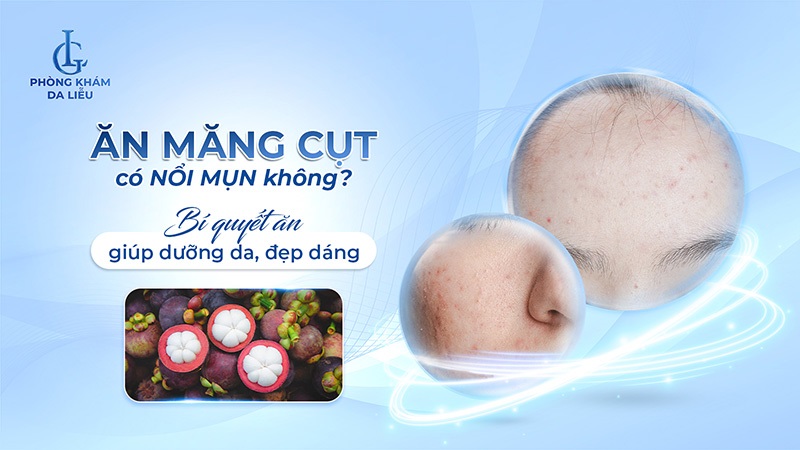 Ăn măng cụt có nổi mụn không