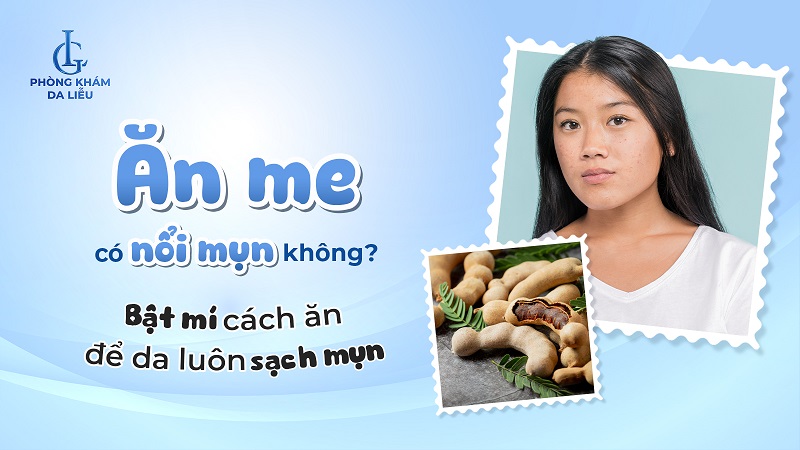 Ăn me có nổi mụn không