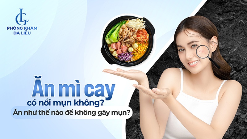 Ăn mì cay có nổi mụn không