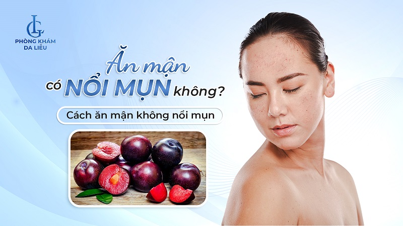ăn mận có nổi mụn không