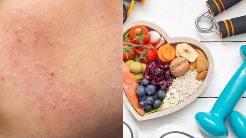 Điều chỉnh chế độ sinh hoạt