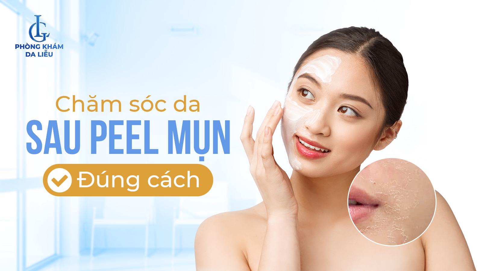Chăm sóc da sau peel mụn