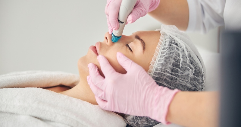 Lột mụn đầu đen ở mũi