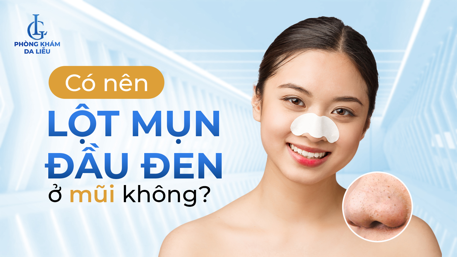 Có nên lột mụn đầu đen ở mũi không
