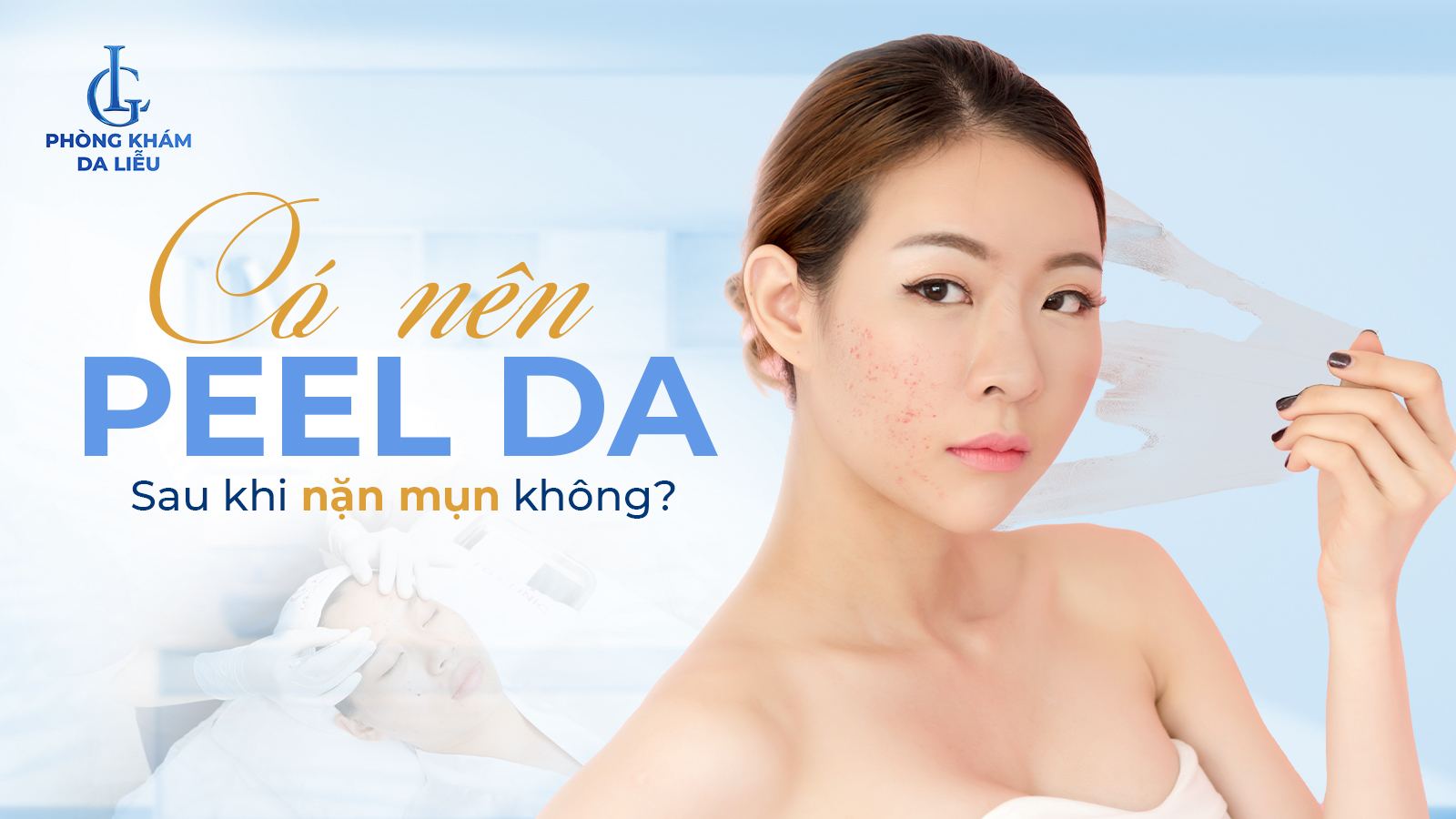 Có nên peel da sau khi nặn mụn