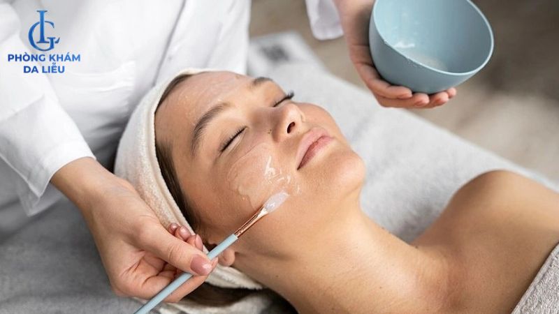 Mụn ẩn có peel da được không