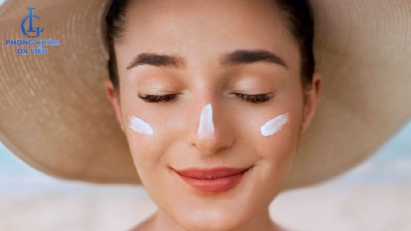 Mụn ẩn có peel da được không