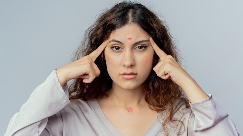 cách trị mụn bọc ở trán tại nhà