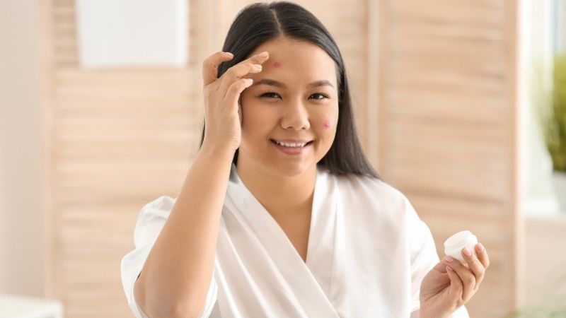 Chăm sóc mụn bọc ở trán đúng cách