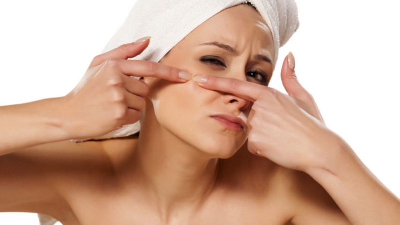 Mụn đầu đen có nên nặn không