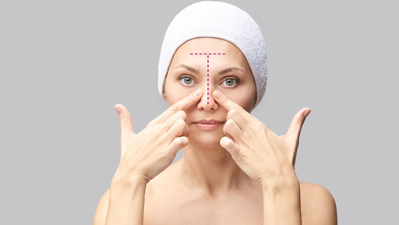 Mụn đầu đen ở mũi